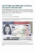 I20 Và F1 Visa Cái Nào Tốt Hơn